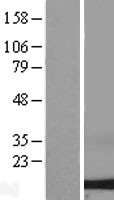 DYNLL2 Protein - Western validation with an anti-DDK antibody * L: Control HEK293 lysate R: Over-expression lysate