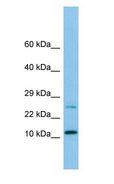 DYNLRB1 Antibody - DYNLRB1 antibody Western Blot of HeLa.  This image was taken for the unconjugated form of this product. Other forms have not been tested.