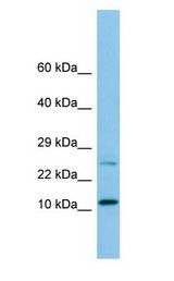 DYNLRB1 Antibody - DYNLRB1 antibody Western Blot of HeLa.  This image was taken for the unconjugated form of this product. Other forms have not been tested.