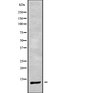 DYNLRB1 Antibody - Western blot analysis of DYNLRB1 using Jurkat whole cells lysates