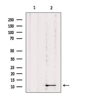 DYNLRB1 Antibody - Western blot analysis of extracts of mouse Myeloma cells using DYNLRB1 antibody. Lane 1 was treated with the blocking peptide.