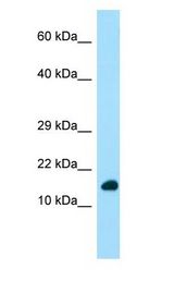 DYNLRB1 Antibody - DYNLRB1 antibody Western Blot of Fetal Heart.  This image was taken for the unconjugated form of this product. Other forms have not been tested.