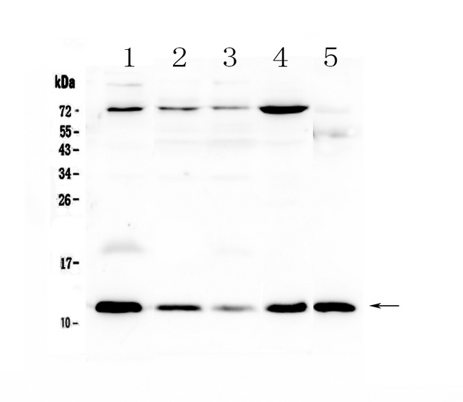 DYNLT1 / TCTEX-1 Antibody - Western blot - Anti-DYNLT1 Picoband antibody