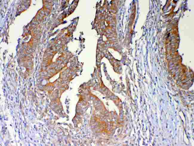 DYNLT1 / TCTEX-1 Antibody - Immunohistochemistry - Anti-DYNLT1 Picoband antibody