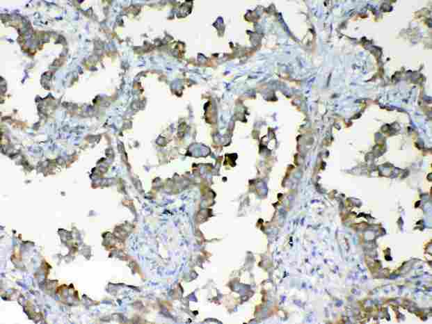 DYNLT1 / TCTEX-1 Antibody - Immunohistochemistry - Anti-DYNLT1 Picoband antibody