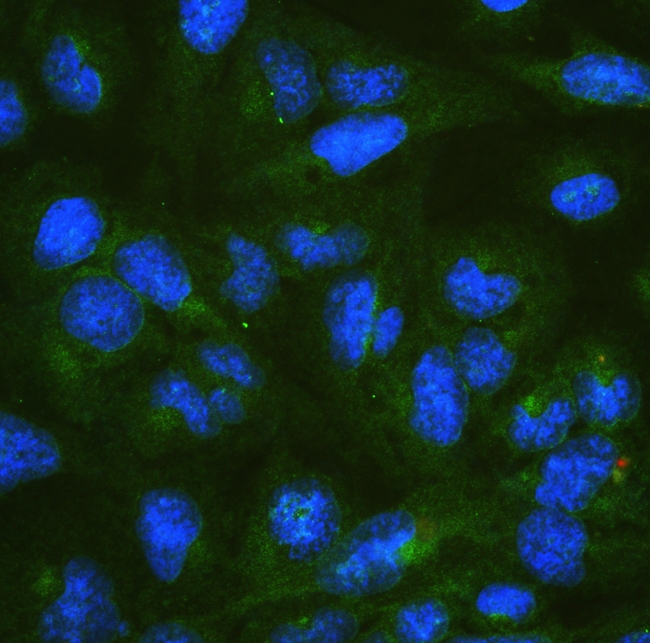 DYNLT1 / TCTEX-1 Antibody - IF analysis of DYNLT1 using anti-DYNLT1 antibody DYNLT1 was detected in immunocytochemical section of U20S cell. Enzyme antigen retrieval was performed using IHC enzyme antigen retrieval reagent for 15 mins. The tissue section was blocked with 10% goat serum. The tissue section was then incubated with 2µg/mL rabbit anti-DYNLT1 Antibody overnight at 4°C. DyLight®488 Conjugated Goat Anti-Rabbit IgG was used as secondary antibody at 1:100 dilution and incubated for 30 minutes at 37°C. The section was counterstained with DAPI. Visualize using a fluorescence microscope and filter sets appropriate for the label used.