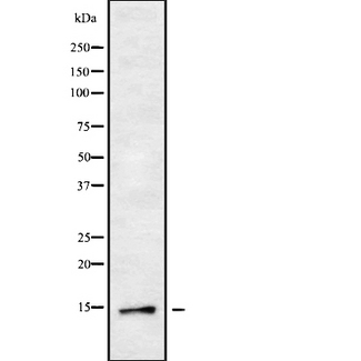 DYNLT3 Antibody - Western blot analysis of DYNLT3 using HeLa whole cells lysates
