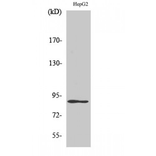 DYRK / DYRK1A Antibody - Western blot of Dyrk1A antibody