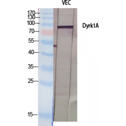DYRK / DYRK1A Antibody - Western blot of Dyrk1A antibody