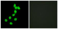 DYRK / DYRK1A Antibody - Immunofluorescence analysis of HepG2 cells, using DYR1A Antibody. The picture on the right is blocked with the synthesized peptide.