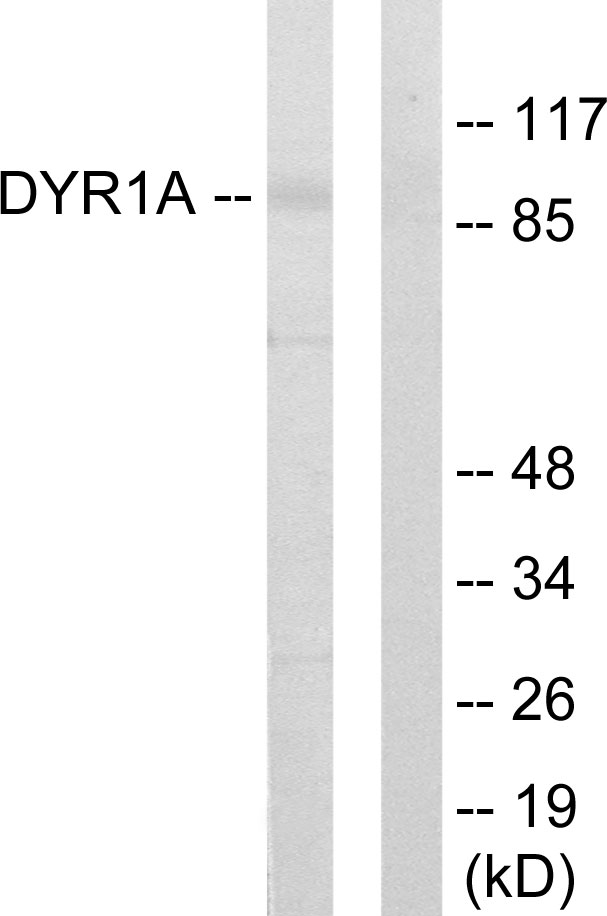 DYRK / DYRK1A Antibody - Western blot analysis of lysates from HepG2 cells, using DYR1A Antibody. The lane on the right is blocked with the synthesized peptide.