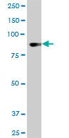 DYRK / DYRK1A Antibody - DYRK1A monoclonal antibody (M01), clone 7D10. Western Blot analysis of DYRK1A expression in 293.