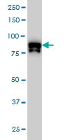 DYRK / DYRK1A Antibody - DYRK1A monoclonal antibody (M01), clone 7D10 Western Blot analysis of DYRK1A expression in HeLa NE.