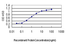 DYRK / DYRK1A Antibody - Detection limit for recombinant GST tagged DYRK1A is approximately 0.03 ng/ml as a capture antibody.