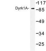 DYRK / DYRK1A Antibody - Western blot of Dyrk1A (Q39) pAb in extracts from HepG2 cells.