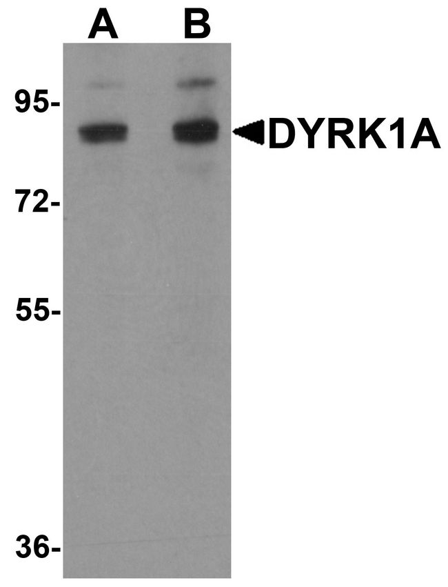 DYRK / DYRK1A Antibody - Western blot analysis of DYRK1A in HeLa cell lysate with DYRK1A antibody at (A) 1 and (B) 2 ug/ml.