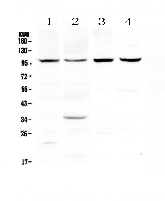 DYRK / DYRK1A Antibody - Western blot - Anti-DYRK1A Picoband antibody