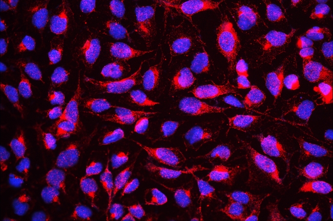 DYRK / DYRK1A Antibody - IF analysis of DYRK1A using anti-DYRK1A antibody DYRK1A was detected in immunocytochemical section of U20S cell. Enzyme antigen retrieval was performed using IHC enzyme antigen retrieval reagent for 15 mins. The tissue section was blocked with 10% goat serum. The tissue section was then incubated with 2µg/mL rabbit anti-DYRK1A Antibody overnight at 4°C. Cy3 Conjugated Goat Anti-Rabbit IgG was used as secondary antibody at 1:100 dilution and incubated for 30 minutes at 37°C. The section was counterstained with DAPI. Visualize using a fluorescence microscope and filter sets appropriate for the label used.