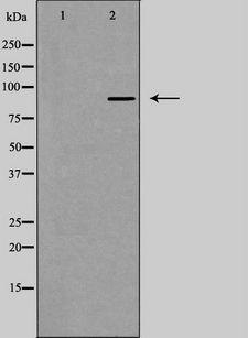 DYRK / DYRK1A Antibody - Western blot analysis of extracts of HepG2 cells using DYR1A antibody. The lane on the left is treated with the antigen-specific peptide.