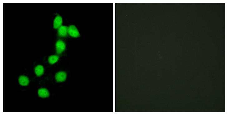 DYRK / DYRK1A Antibody - Peptide - + Immunofluorescence analysis of HepG2 cells, using DYR1A antibody.