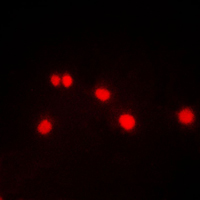 DYRK / DYRK1A Antibody - Immunofluorescent analysis of DYRK1A staining in HeLa cells. Formalin-fixed cells were permeabilized with 0.1% Triton X-100 in TBS for 5-10 minutes and blocked with 3% BSA-PBS for 30 minutes at room temperature. Cells were probed with the primary antibody in 3% BSA-PBS and incubated overnight at 4 C in a humidified chamber. Cells were washed with PBST and incubated with a DyLight 594-conjugated secondary antibody (red) in PBS at room temperature in the dark. DAPI was used to stain the cell nuclei (blue).