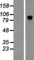 DYRK / DYRK1A Protein - Western validation with an anti-DDK antibody * L: Control HEK293 lysate R: Over-expression lysate