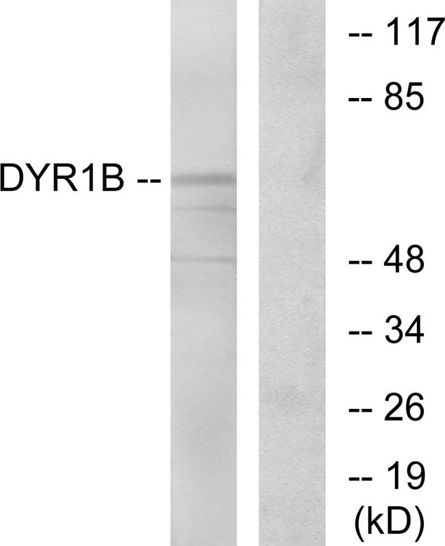 DYRK1B Antibody - Western blot analysis of lysates from Jurkat cells, using DYR1B Antibody. The lane on the right is blocked with the synthesized peptide.