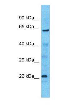 DYRK1B Antibody - Western blot of DYRK1B Antibody with Lung Tumor lysate.  This image was taken for the unconjugated form of this product. Other forms have not been tested.