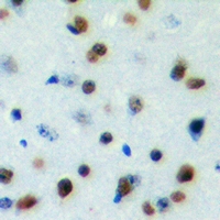 DYRK1B Antibody - Immunohistochemical analysis of DYRK1B staining in human brain formalin fixed paraffin embedded tissue section. The section was pre-treated using heat mediated antigen retrieval with sodium citrate buffer (pH 6.0). The section was then incubated with the antibody at room temperature and detected with HRP and DAB as chromogen. The section was then counterstained with hematoxylin and mounted with DPX.