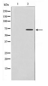 DYRK1B Antibody - Western blot of Jurkat cell lysate using DYR1B Antibody
