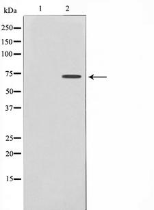 DYRK1B Antibody - Western blot analysis on Jurkat cell lysates using DYR1B antibody. The lane on the left is treated with the antigen-specific peptide.