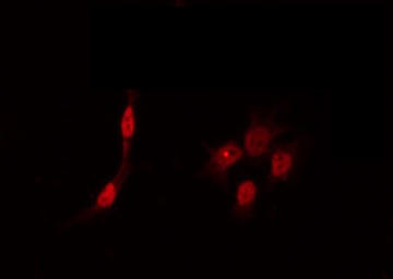DYRK1B Antibody - Staining HeLa cells by IF/ICC. The samples were fixed with PFA and permeabilized in 0.1% Triton X-100, then blocked in 10% serum for 45 min at 25°C. The primary antibody was diluted at 1:200 and incubated with the sample for 1 hour at 37°C. An Alexa Fluor 594 conjugated goat anti-rabbit IgG (H+L) Ab, diluted at 1/600, was used as the secondary antibody.