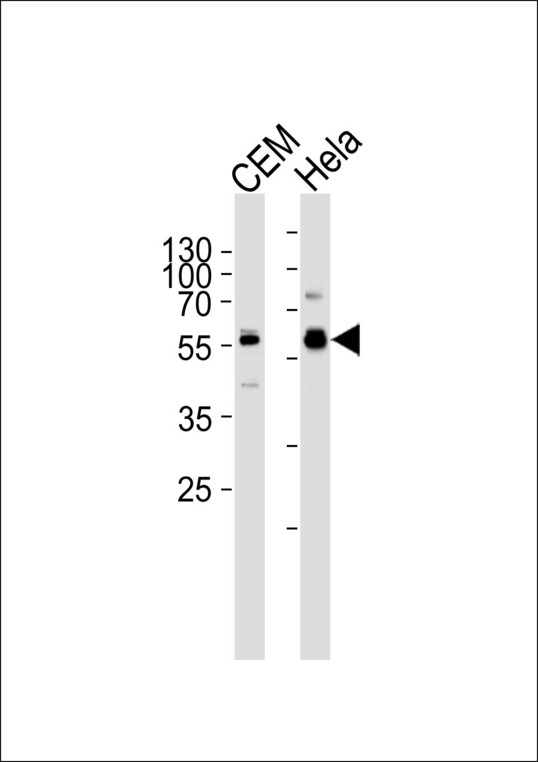 DYRK2 Antibody - Western blot of lysates from CEM, HeLa cell line (from left to right), using DYRK2 Antibody (P46). Antibody was diluted at 1:1000 at each lane. A goat anti-rabbit IgG H&L (HRP) at 1:5000 dilution was used as the secondary antibody. Lysates at 35ug per lane.