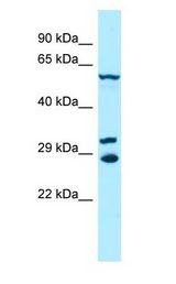 DYRK2 Antibody - DYRK2 antibody Western Blot of Jurkat.  This image was taken for the unconjugated form of this product. Other forms have not been tested.