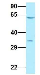 DYRK2 Antibody - DYRK2 antibody Western Blot of Human Fetal Lung. Antibody Dilution: 1.0 ug/ml. Antibody dilution: 1 ug/ml.  This image was taken for the unconjugated form of this product. Other forms have not been tested.
