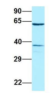 DYRK2 Antibody - DYRK2 antibody Western Blot of Human Placenta. Antibody Dilution: 1.0ug/ml. Antibody dilution: 1 ug/ml.  This image was taken for the unconjugated form of this product. Other forms have not been tested.
