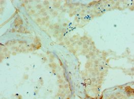 DYRK2 Antibody - Immunohistochemistry of paraffin-embedded human testicle using antibody at 1:100 dilution.