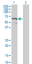DYRK2 Antibody - Western blot of DYRK2 expression in transfected 293T cell line by DYRK2 monoclonal antibody (M04), clone 2F9.