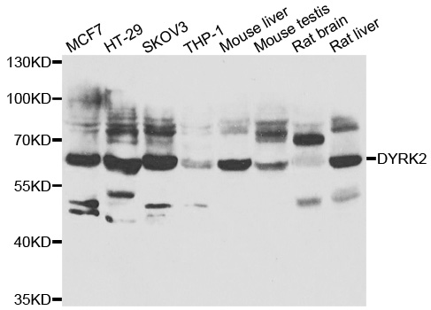 DYRK2 Antibody - Western blot analysis of extracts of various cell lines.