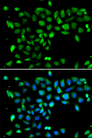 DYRK2 Antibody - Immunofluorescence analysis of U20S cells.
