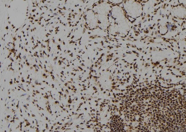 DYRK2 Antibody - 1:100 staining human gastric tissue by IHC-P. The sample was formaldehyde fixed and a heat mediated antigen retrieval step in citrate buffer was performed. The sample was then blocked and incubated with the antibody for 1.5 hours at 22°C. An HRP conjugated goat anti-rabbit antibody was used as the secondary.