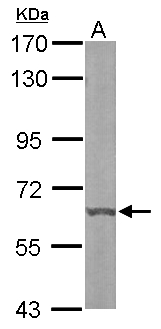 DYRK3 Antibody - Sample (50 ug of whole cell lysate). A: mouse liver. 7.5% SDS PAGE. DYRK3 antibody diluted at 1:1000.