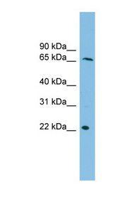 DYRK3 Antibody - DYRK3 antibody Western blot of THP-1 cell lysate. This image was taken for the unconjugated form of this product. Other forms have not been tested.