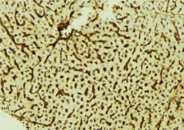 DYRK3 Antibody - 1:100 staining mouse liver tissue by IHC-P. The sample was formaldehyde fixed and a heat mediated antigen retrieval step in citrate buffer was performed. The sample was then blocked and incubated with the antibody for 1.5 hours at 22°C. An HRP conjugated goat anti-rabbit antibody was used as the secondary.
