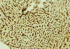 DYRK3 Antibody - 1:100 staining mouse liver tissue by IHC-P. The sample was formaldehyde fixed and a heat mediated antigen retrieval step in citrate buffer was performed. The sample was then blocked and incubated with the antibody for 1.5 hours at 22°C. An HRP conjugated goat anti-rabbit antibody was used as the secondary.