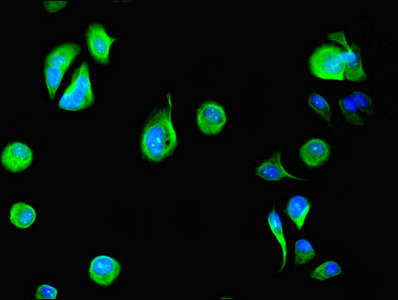 DYRK4 Antibody - Immunofluorescent analysis of MCF-7 cells using DYRK4 Antibody at dilution of 1:100 and Alexa Fluor 488-congugated AffiniPure Goat Anti-Rabbit IgG(H+L)