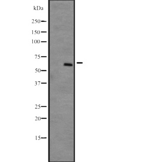 DYRK4 Antibody - Western blot analysis of DYRK4 expression in NCI-H292 cells line lysates;developed using the ECL technique. The lane on the left is treated with the antigen-specific peptide.