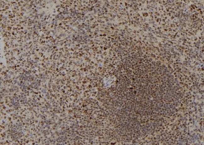 DYRK4 Antibody - 1:100 staining mouse spleen tissue by IHC-P. The sample was formaldehyde fixed and a heat mediated antigen retrieval step in citrate buffer was performed. The sample was then blocked and incubated with the antibody for 1.5 hours at 22°C. An HRP conjugated goat anti-rabbit antibody was used as the secondary.