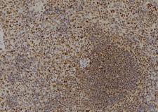 DYRK4 Antibody - 1:100 staining mouse spleen tissue by IHC-P. The sample was formaldehyde fixed and a heat mediated antigen retrieval step in citrate buffer was performed. The sample was then blocked and incubated with the antibody for 1.5 hours at 22°C. An HRP conjugated goat anti-rabbit antibody was used as the secondary.