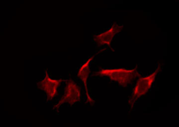 DYRK4 Antibody - Staining 293 cells by IF/ICC. The samples were fixed with PFA and permeabilized in 0.1% Triton X-100, then blocked in 10% serum for 45 min at 25°C. The primary antibody was diluted at 1:200 and incubated with the sample for 1 hour at 37°C. An Alexa Fluor 594 conjugated goat anti-rabbit IgG (H+L) Ab, diluted at 1/600, was used as the secondary antibody.